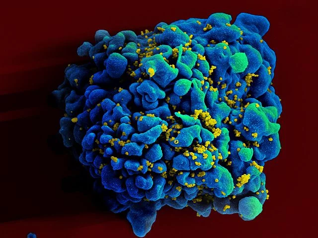 hiv-infected_h9