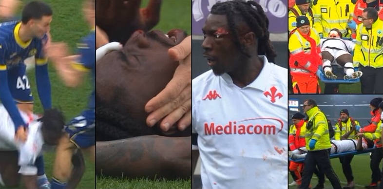 kean-fiorentina Моизе Кин